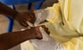 A nurse wearing white glove takes a sample from a child with a suspected case of mpox