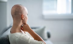 Stock image of a person with a shaved head.