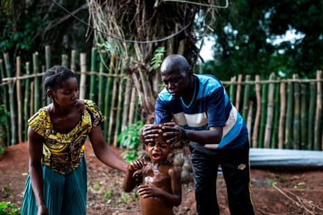 A health worker and a mother attend to a boy at a makeshift paediatric health centre after an outbreak of malaria in June in the district of Muma, Democratic Republic of the Congo.