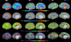 MRI brain scans of babies aged seven to nine months.