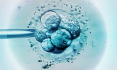 Embryo selection for IVF light micrograph