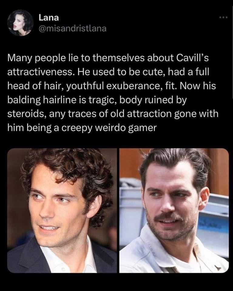 Lana @misandristlana Many people lie to themselves about Cavill's attractiveness. He used to be cute, had a full head of hair, youthful exuberance, fit. Now his balding hairline is tragic, body ruined by steroids, any traces of old attraction gone with him being a creepy weirdo gamer