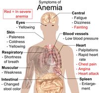 Vitamin Deficiency Anemia Causes, Symptoms, Diagnoses and Treatment