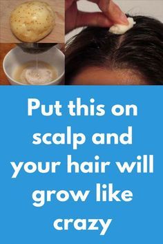 Thick Hair Remedies, How To Grow Your Hair Faster, Hair Remedies For Growth, New Hair Growth, Home Remedies For Hair, Baking Soda Shampoo, Grow Hair Faster, Hair Growth Faster, Hair Remedies