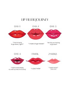 This Templates item by NurseLaurenDesigns has 32 favorites from Etsy shoppers. Ships from United States. Listed on Apr 18, 2024 Lip Anatomy Injection, Lip Filler Types, Lip Filler Timeline, Lip Fillers Healing Process, Aesthetic Injector Instagram, Aesthetics Nurse Injector, Botox Placement Chart, Botox Timeline, Lip Filler Mapping