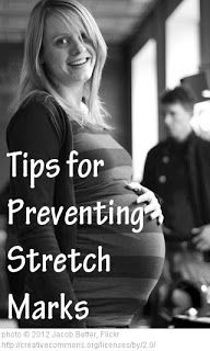 Stretch marks are common for pregnant women, people who work out or anyone who has rapidly gained or lost weight. This blog posts talks about how to prevent and treat stretch marks. Great info! #skincare #pregnancy #stretchmarks Gain Weight For Women, Dry Skin Patches, Nail Fashion, Dermatologist Recommended, Healthy Pregnancy, Getting Pregnant, Nails Nail, Beautiful Skin, Future Baby