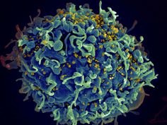 In a significant medical milestone, a 60-year-old German man has become the seventh person in history to apparently be cured of HIV.