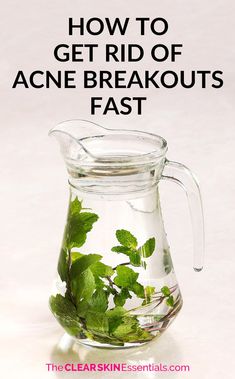 I was plagued with acne and breakouts for well over a decade until I figured out what to do with my skincare and diet to get rid of acne breakouts fast and easy. Click through to find out what I do whenever pimples or breakouts start creeping up. These 5 things help stop pimples in their tracks and prevents scars and marks from being left behind. | www.TheClearSkinEssentials.com Severe Acne Remedies, Cystic Acne Remedies, Being Left Behind, Acne Overnight, Get Rid Of Acne, Rid Of Acne, Natural Acne, Natural Acne Remedies, Diy Kosmetik