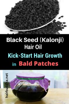 Black seed (Kalonji) hair oil is the ancinet and most effective remedy for hair loss and bald patches. I have used this oil and saw new growth in days. Bald Hair Growth, Scalp Hair Growth, Bald Patches, New Hair Growth, Lost Hair, Black Seed, Hair Growth Oil, New Growth