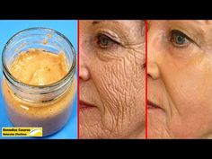 an older woman's face before and after rejuicing