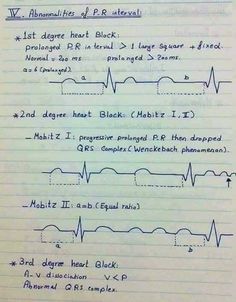 Ekg Rhythms, Notes Instagram, Ekg Interpretation, Pr Interval, Heart Blocks, Respiratory Therapy