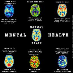 an image of the brain and its functions in different areas of the human body, as well as other things that are related to it