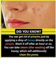 Natural Skin Care Remedies, Natural Face Skin Care, Interesting Facts About World, Amazing Science Facts, Good Skin Tips, How To Get Rid Of Pimples, Psychology Fun Facts, Natural Skin Care Diy, Wow Facts