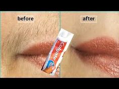 the before and after image shows how to use toothpaste on your lips with this trick