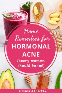 Remedies For Hormonal Acne, Get Rid Of Hormonal Acne, Hormonal Acne Diet, Hormonal Acne Supplements, Acne Supplements, Hormonal Acne Remedies, Acne Diet, Ginger Benefits