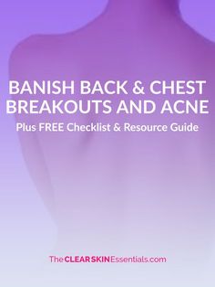 How To Get Rid Of Back & Chest Breakouts And Acne (plus free checklist & resource guide) Chest And Back Acne, Get Rid Of Back Acne, Rid Of Back Acne, Back Acne Remedies, Back Acne