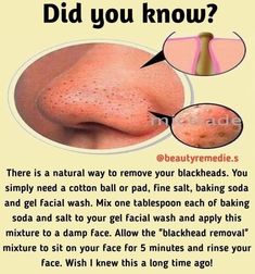 Healthy Skin Tips, Skin Care Remedies, Skin Care Natural, Natural Face Skin Care, Natural Skin Care Remedies, Good Skin Tips, Perfect Skin Care Routine, Natural Skin Care Diy, Facial Skin Care Routine