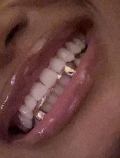 #grillz Teeth Jewelry Aesthetic, Tooth Caps, Gangsta Grillz, Smile Tips, Jewel Tattoo, Brace Face