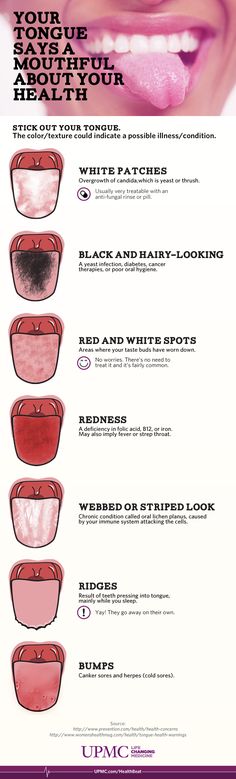 Next time you're in front of the mirror, check out your tongue - it can tell you a lot about your health! Kedokteran Gigi, Kesehatan Gigi, Tongue Health, Oil Pulling, Dental Hygiene, Oral Hygiene