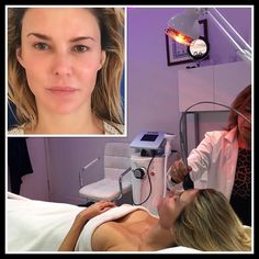 Brandi Glanville Shows Results of Skin Tightening Procedure  | ExtraTV.com Diy Skin Toner, Skin Tightening Procedures, Brandi Glanville, Non Surgical Facelift, Skin Toner, No Makeup, Jan 17, Diy Skin, Free Makeup