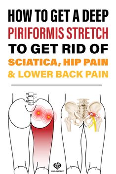 Sciatic Nerve Stretches, Yoga Poses For Sleep, Partner Yoga Poses, Piriformis Muscle, Hip Pain Relief, Piriformis Stretch, Yoga Poses Names, Sciatica Exercises, Sciatica Pain Relief