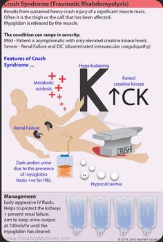 an info poster showing the different types of medical devices and how they are used to treat them