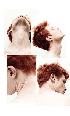 four different views of a man's head and neck