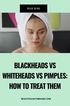 Curious about how to treat whiteheads, blackheads, and pimples? Discover the differences between these common skin issues and learn the best treatment methods to achieve a clear complexion.About: Acne solutions, skincare guide Different Types Of Acne, Skincare Guide, Types Of Acne, Acne Solutions, Clear Complexion, Skin Issues