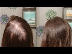 Fine Hair Styles For Women, Parting Hair, Hair Fixing, Split Hair, Hair Solutions, Head Hair, Crown Hairstyles, Cool Haircuts