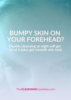 How To Get Rid Of Bumpy Skin On Your Forehead - www.TheClearSkinEssentials.com Bumpy Forehead, Forehead Pimples, Beauty Recommendations, Chest Acne, Double Cleanse, Forehead Acne, Acne Face Wash, Bumpy Skin, Double Cleansing