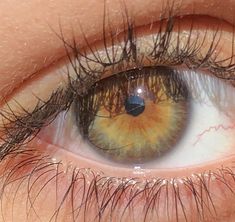 Central Heterochromia Eyes, Dr Claims, Central Heterochromia, Heterochromia Eyes, Hazel Eye