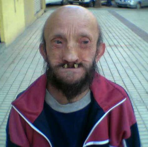 World's Ugliest Guys - Gallery Funny Mugshots, Old Man Pictures, Funny Faces Pictures, Beteg Humor, Ugly Photos, Bad Teeth, Funny People Pictures, Smiling Man, Face Pictures