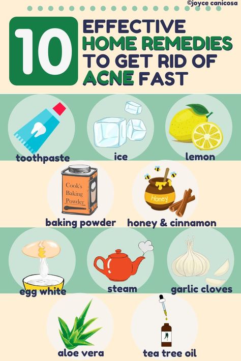How To Stop Acne, Foods That Clear Acne, Face Acne Remedies, Facials For Acne, Acne Clearing Foods, Clear Acne Overnight, Get Rid Of Acne Fast, Diy Acne Mask, Clear Up Acne