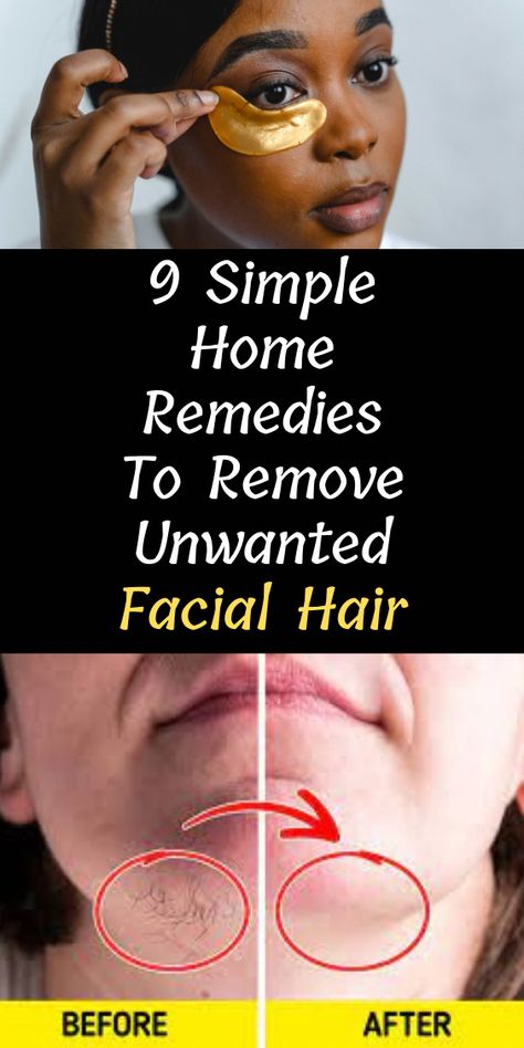 Remove Unwanted Facial Hair Bear in mind that we also have weather conditions not favorable for a healthy skin. Hope these tricks help...... Waxing Vs Shaving, Natural Hair Removal Remedies, Remove Body Hair Permanently, Face Hair Removal, Natural Hair Removal, Unwanted Hair Permanently, Remove Unwanted Facial Hair, Underarm Hair Removal, Unwanted Facial Hair