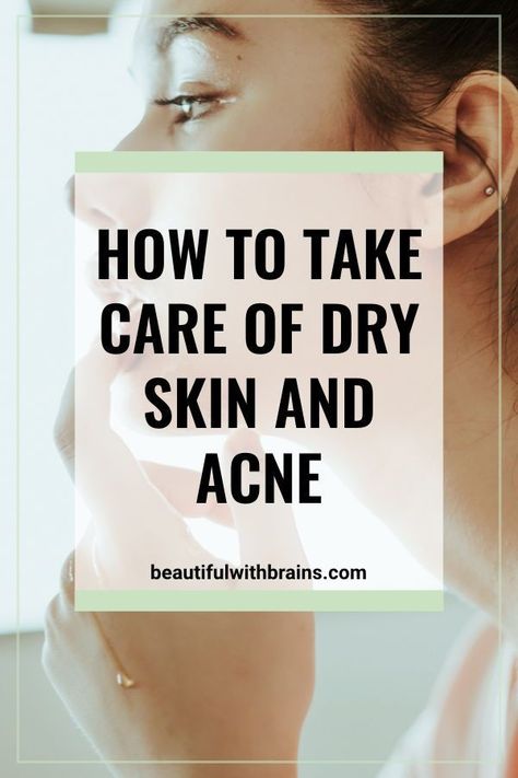 Dry Skin Acne, Normal Skin Type, Skin Acne, Dry Skin Care, Acne Remedies, Skin Remedies, Normal Skin, Acne Prone, Acne Prone Skin