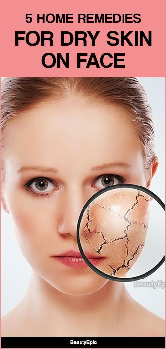 Home Remedies for Dry Skin on Face Remedies For Dry Skin On Face, What To Use For Dry Skin On Face, Dry Facial Skin Remedy, Dry Face Skin Remedies, How To Treat Dry Skin On Face, Dry Skin On Face Remedies, Home Remedy For Dry Skin On Face, Dry Skin Remedies For Face Home Made, Face Dry Skin Remedies