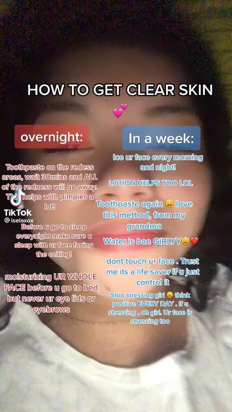 Skin Care Routine No Products, How To Make Your Skin Clear Overnight, Tips On Clear Skin, How To Get Clear Skin Naturally Overnight, How To Clear Body Acne Fast, How To Make Skin Clear And Glow, To Get Clear Skin, How To Not Get Pimples Clear Skin, How To Get Natural Clear Skin