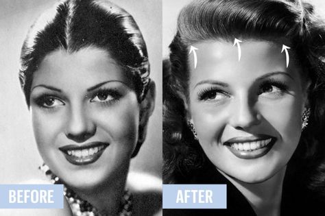 Hairline Laser Hair Removal, Rita Hayworth Before And After, Rita Hayworth Hair, Marilyn Monroe Plastic Surgery, Old Hollywood Beauty, Old Hollywood Makeup, Extreme Plastic Surgery, Weird Beauty, Old Hollywood Hair