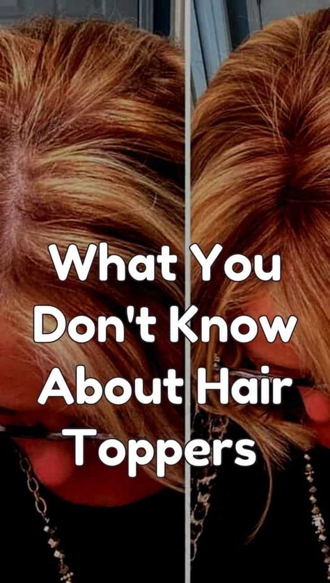 Hair Styles Thinning Hair Women, Kos, Lorraine, Curly Toppers For Thinning Hair, Wigs For Thinning Hair, Wiglets For Short Hair, Short Hair Toppers For Thinning Hair For Women, Wavy Hair Toppers For Thinning Hair, Hair Styles For Extremely Fine Hair