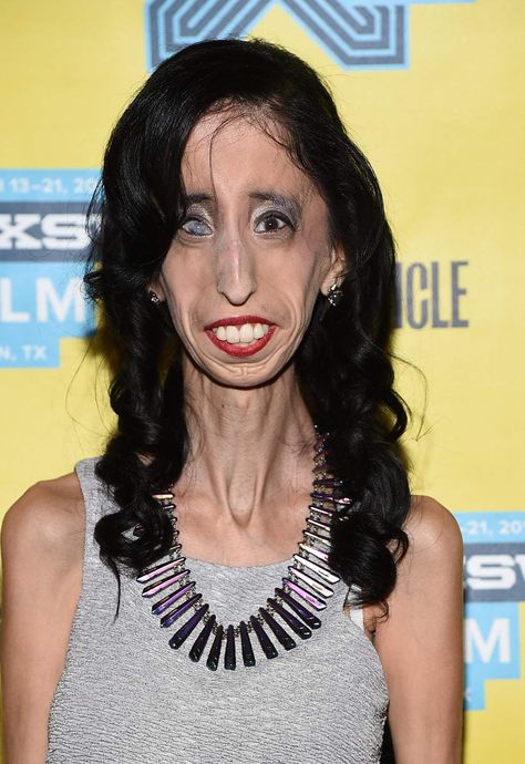 The world's ugliest woman, Lizzie Velasquez is now an anti-bullying activist and motivational speaker. Ugly Photos, Celebrities Before And After, Model Face, Russian Women, Cute Celebrities, Interesting Faces, Famous Celebrities, Plastic Surgery, Black Women Hairstyles