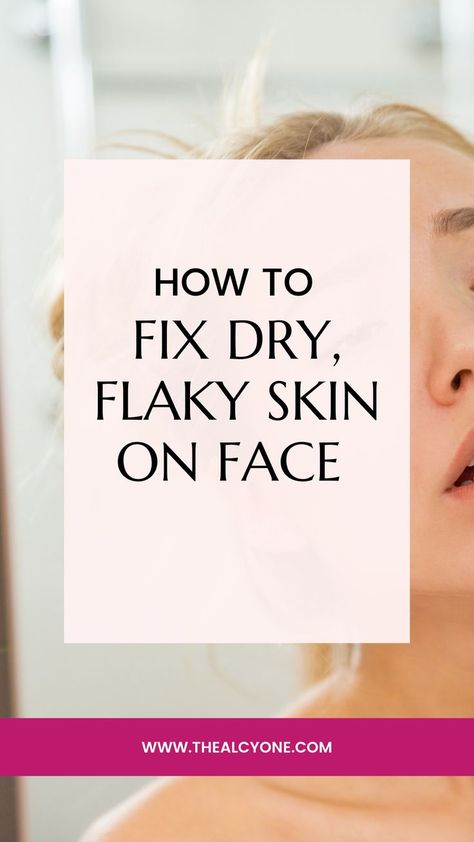 How To Fix Dry Skin On Face, Flaky Face Skin, Extra Dry Skin Remedies, Chapped Face Remedy Skin, How To Get Rid Of Flaky Skin On Face, Dry Patchy Skin On Face, Dry Forehead Remedies, What To Use For Dry Skin On Face, How To Remove Dry Skin From Face