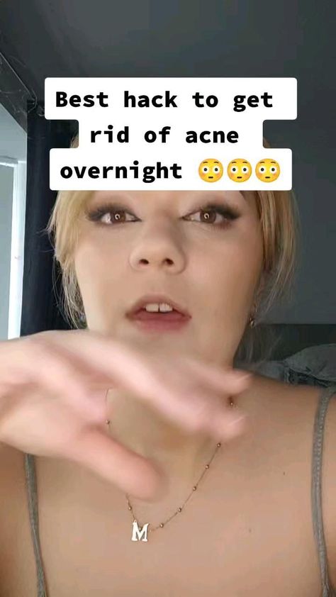 How to get rid of acne overnight #acne #beauty #pimple #facial #Wellness #HealthyLiving #NutritionTips #FitLife #FitnessTips #HealthTips #SelfCare #HealthyLifestyle Rid Of Acne Overnight, Get Rid Of Acne Overnight, Clear Skin Overnight, Acne Beauty, Pimples Under The Skin, Acne Overnight, Pimples Overnight, Pimples Remedies, Natural Face Skin Care