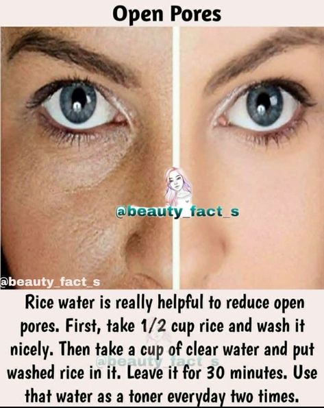 Daglig Motivation, Natural Skin Care Ingredients, Skin Face Mask, Clear Skin Face, Clear Healthy Skin, Natural Skin Care Remedies, Natural Face Skin Care, Good Skin Tips, Rice Water