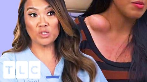 The Contents Of This Huge Bump Surprises Dr Lee | Dr. Pimple Popper Dr Sandra Lee Pimple Popper Videos, Dr Pimple Popper Blackhead Youtube, Mr Pimple Popper, Doctor Pimple Popper Videos, Huge Pimple Pop Video, Big Pimple Poppìng Videos, Huge Blackheads Popping, Dr Pimple Popper Youtube, Boil Popping Videos