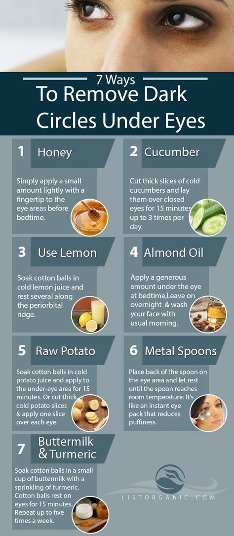 Remove Dark Circles Under Eyes, Foods For Healthy Skin, Dark Eye Circles, Diy Skin Care Routine, Clear Healthy Skin, Face Care Tips, Natural Skin Care Remedies, Natural Face Skin Care, Good Skin Tips