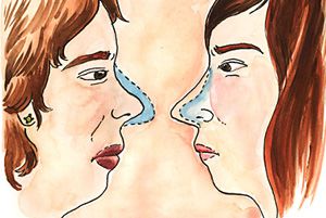 A woman's reflection on her nose job and on parenting a daughter with a stereotypical Jewish nose. Jewish Nose, A Bridge Too Far, Nose Jobs, Jewish Girl, Jewish Women, Ideal Beauty, Arts And Culture, Saying No, Nose Job