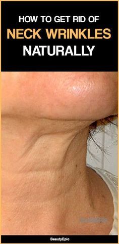 Saggy Neck, Expensive Beauty Products, Wrinkle Remedies, Lip Care Routine, Neck Wrinkles, Anti Aging Secrets, Anti Aging Supplements, Skin Care Wrinkles, Face Wrinkles