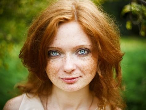 Certain genetic traits are incredibly rare in humans, especially relating to hair and eye colour, but the intersection of rare traits? Super rare. Rarest Hair Color, Rare Eye Colors, Vibrant Red Hair, Rare Eyes, Laser Clinic, Intense Pulsed Light, Bright Blue Eyes, Laser Clinics, Ash Blonde Hair