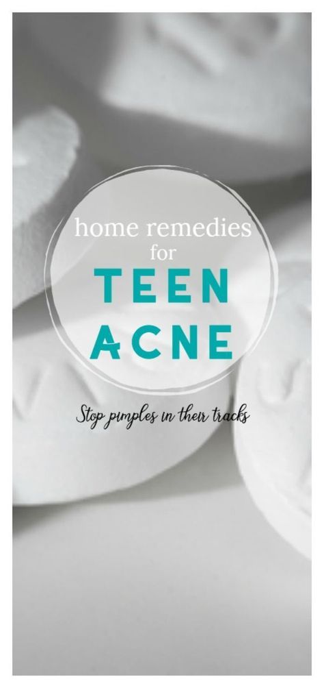 Oily Skin Remedy, How To Reduce Pimples, Bad Acne, Pimples Overnight, Skin Care Routine For 20s, Diy Acne, How To Remove Pimples, Natural Acne, Natural Acne Remedies