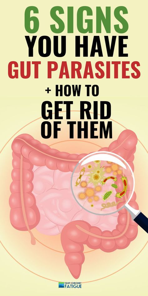 Stomach parasites symptoms - are they causing your fatigue or other health issues? #stoamchparasitessymptoms #stomachparasites #stomachparasitecleanse Parasites Symptoms, Intestinal Parasites, Cleaning Your Colon, Parasite Cleanse, Stomach Issues, Stomach Problems, Home Health Remedies, Colon Cleanse, Lose 40 Pounds